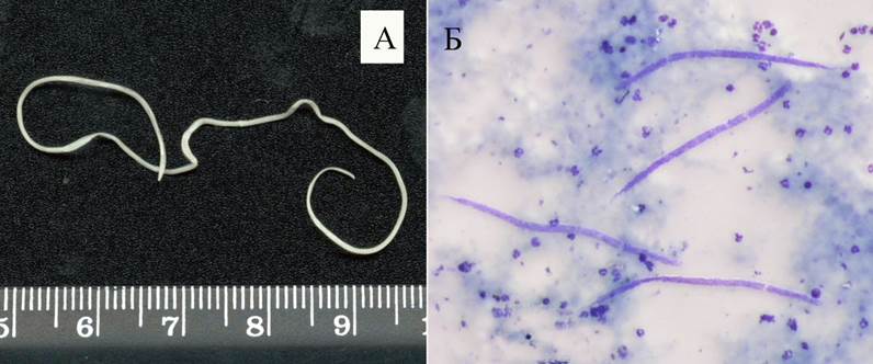 микрофилярии