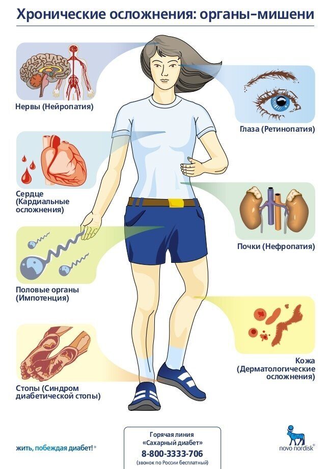 Осложнения сахарного диабета схема