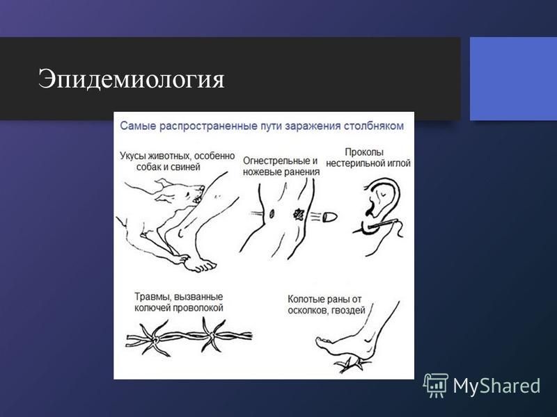 Что нельзя делать после столбняка