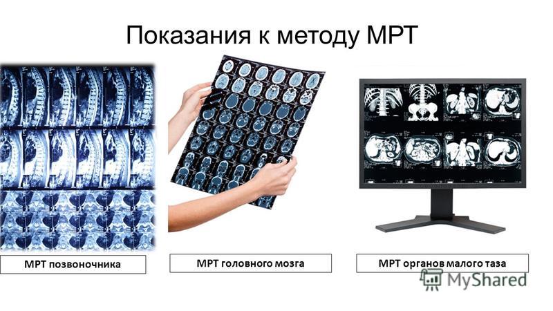 Мрт мозга домодедово