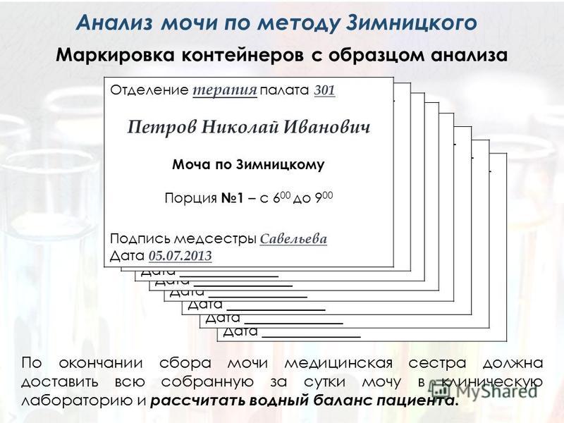 Анализ мочи по зимницкому картинки