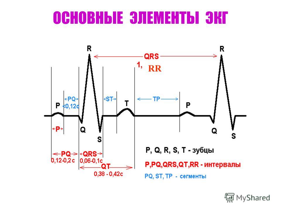 Экг сердца презентация