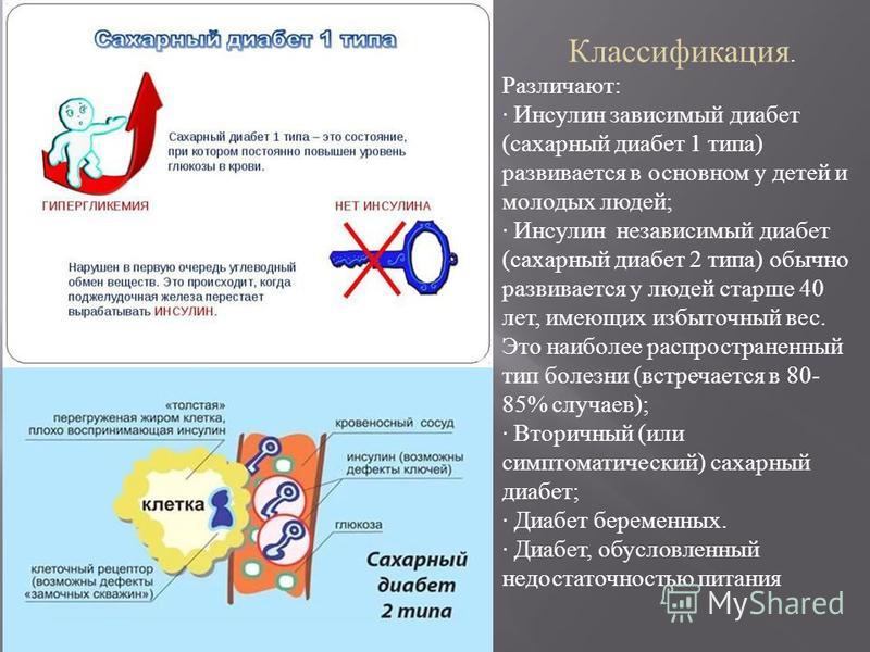 Диабет 2 типа какие