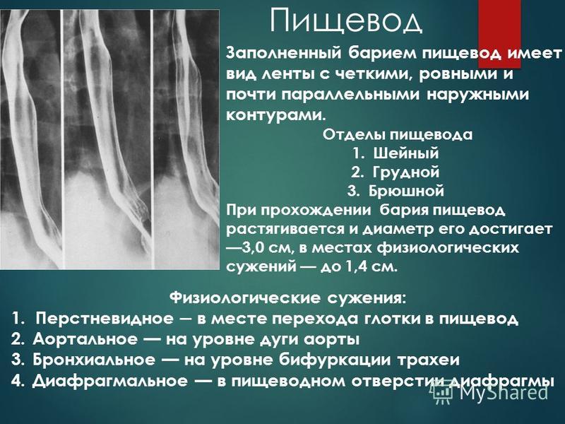 Презентация на тему барий