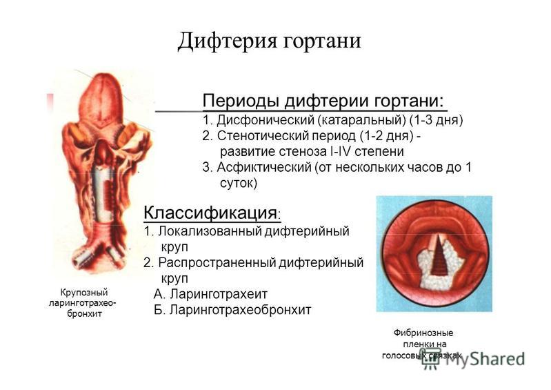 Стеноз аортального клапана степени