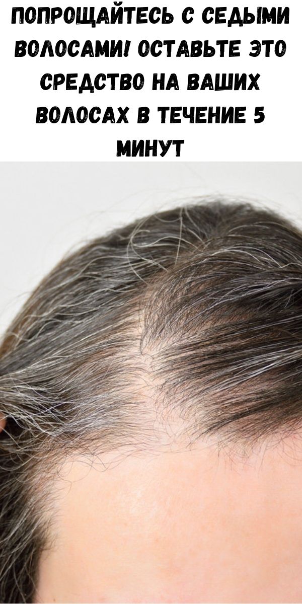 Почему седые волосы растут быстрее чем нормальные