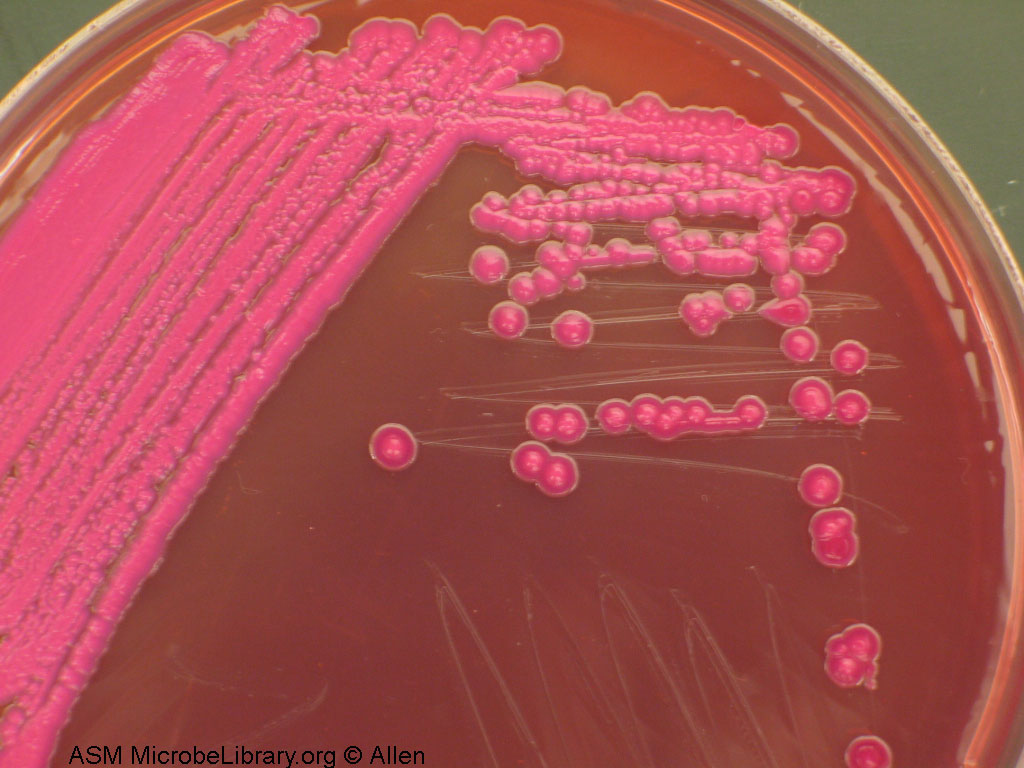 Escherichia coli лактозонегативная