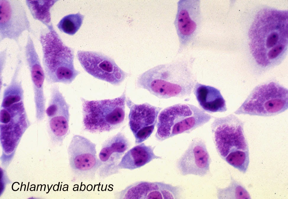 Хламидии 4. Хламидиоз Романовскому-Гимзе. Chlamydia trachomatis микроскопия. Микроскопия мазка хламидии.