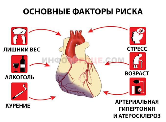 Симптомы болезни сердца. Основные факторы риска инфаркта миокарда. Факторы риска развития инфаркта миокарда. Симптомы ИБС инфаркт миокарда. ИБС инфаркт миокарда факторы риска.