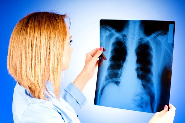 Туберкулёз лёгких или чахотка – это очень опасное заболевание, которое до XX столетия считалось неизлечимым