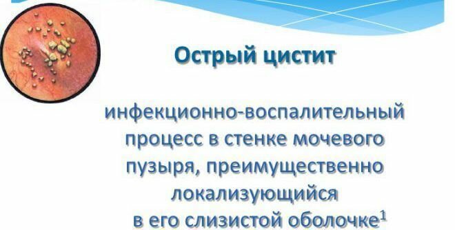 Острый цистит форум. Острый геморрагический цистит. Хронический геморрагический цистит. Острый и хронический цистит. Геморрагический цистит у женщин.