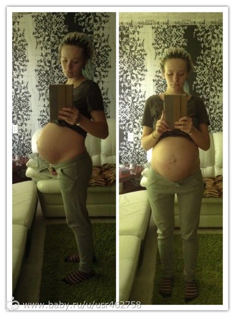 39 недель активно шевелится. Каменеет живот при беременности. Живот на 37 неделе беременности. Живот на 39 неделе беременности.