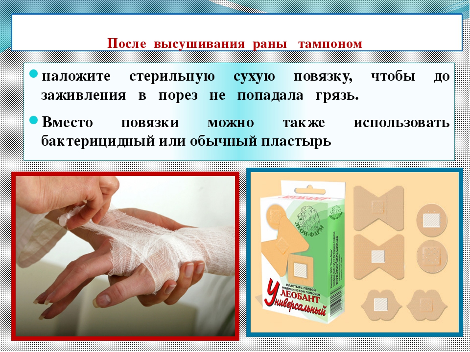 Как лечить рану. Оказание первой помощи при резаных ранах. Оказание первой медицинской помощи при порезах и кровотечениях. Алгоритм оказания первой помощи при порезе.