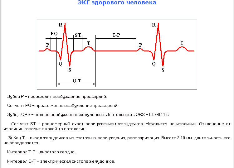 На рисунке изображен фрагмент электрокардиограммы человека