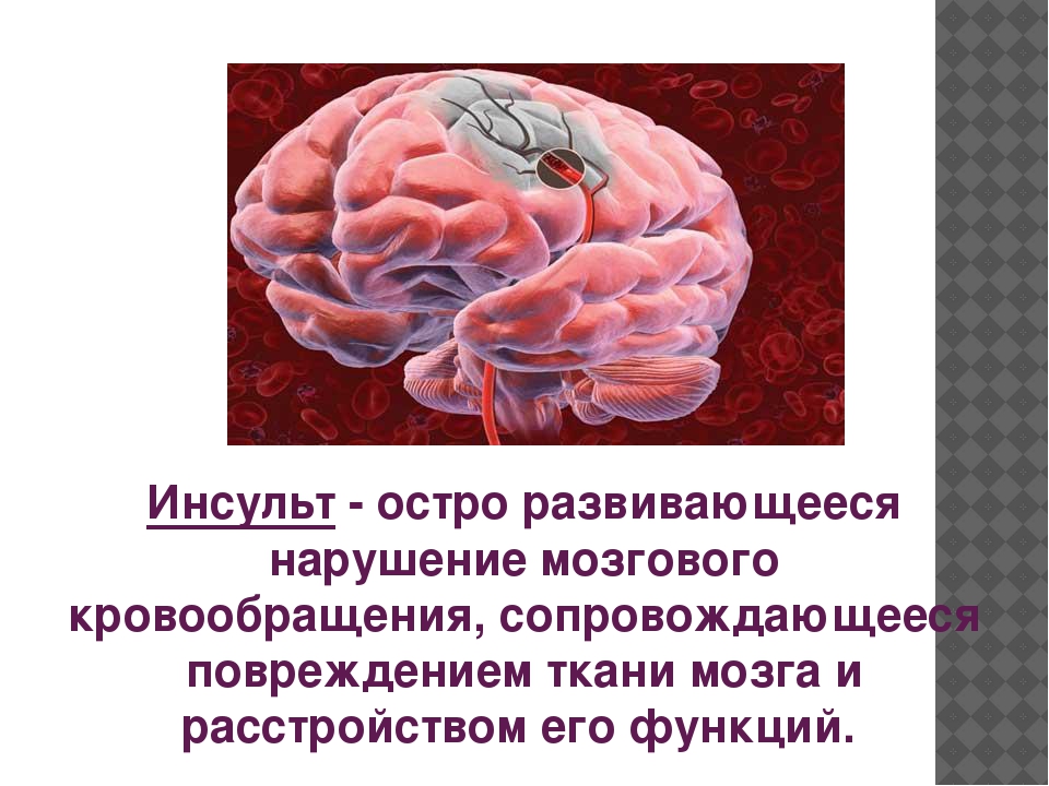 Мозговые нарушения. Мозговой инсульт-острое нарушение мозгового кровообращения. Инсульт это острое нарушение мозгового кровообращения. Нарушение кровоснабжения головного мозга. Острое нарушение кровообращения мозга.