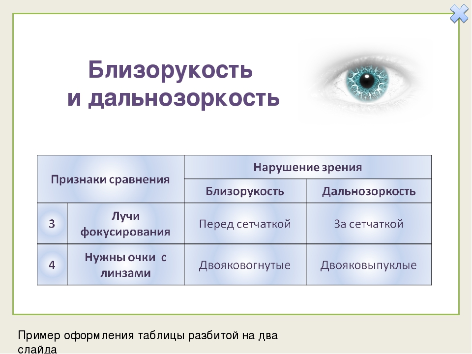 Причины возникновения дальнозоркости. Таблица заболевания глаз близорукость и дальнозоркость. Причины нарушения зрения близорукость дальнозоркость. Таблица нарушение зрения близорукость дальнозоркость. Причины нарушения зрения таблица.