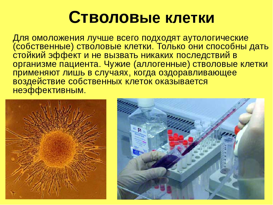 1 стволовые клетки. Стволовые клетки. Стволовые клетки для омоложения. Стволовые клетки трансплантация. Стволовые клетки презентация.
