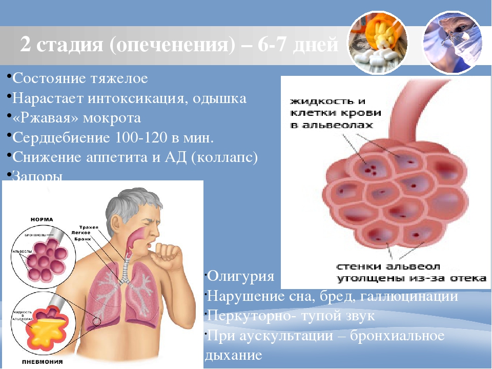 5 дней состояние тяжелое