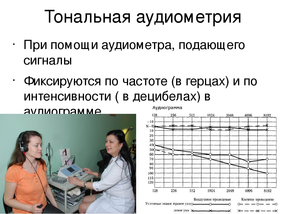 Нормальный слух у человека. Тональная пороговая аудиометрия методика. Аудиометрия является методом исследования. Аудиограмма слуха костная и воздушная. Аудиометрия методика проведения тональная.