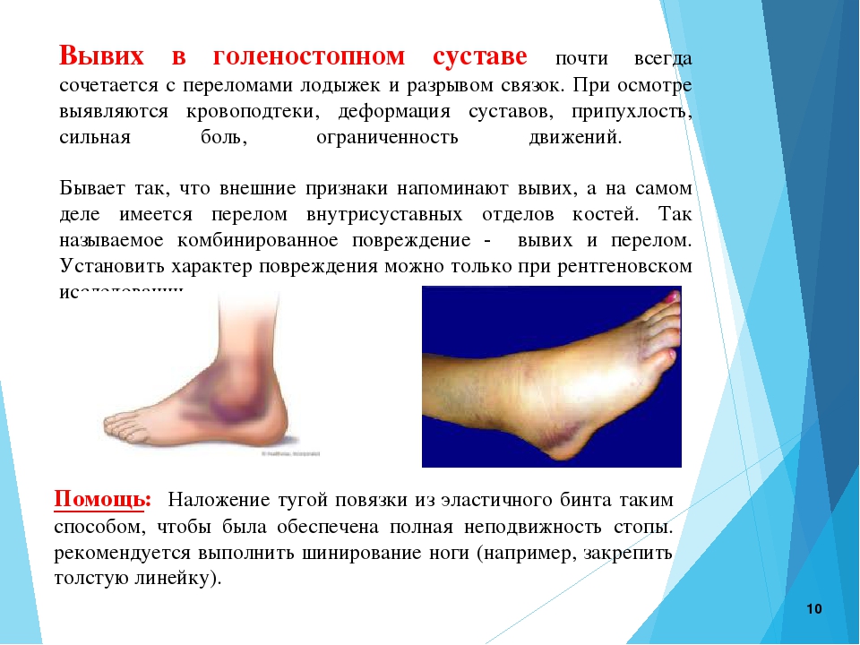 Закрытый перелом нижней трети голени карта вызова