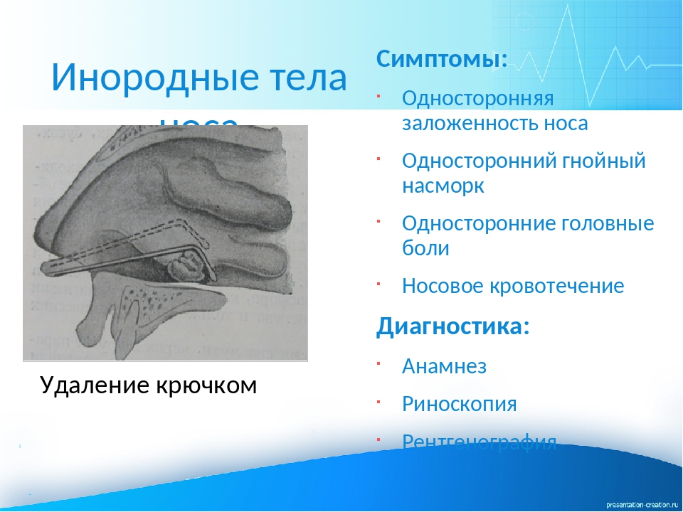 Инородное тело носа карта вызова скорой медицинской помощи