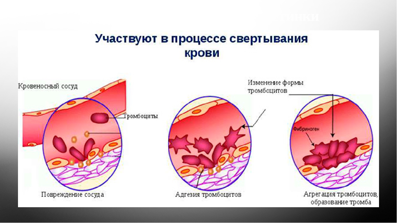 Факторы образования тромба. Тромбоциты участвуют в процессе свертывания крови. Тромбоциты участвуют в свертывании крови. Тромбоциты функция свертывание крови. Участие тромбоцитов в свертывании крови.