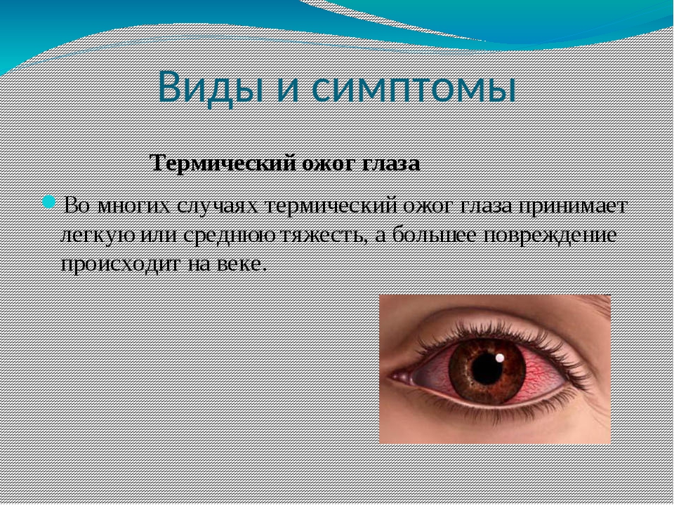 Заболевания и повреждения глаз. Термическая травма глаза. Симптомы при ожогах глаз.