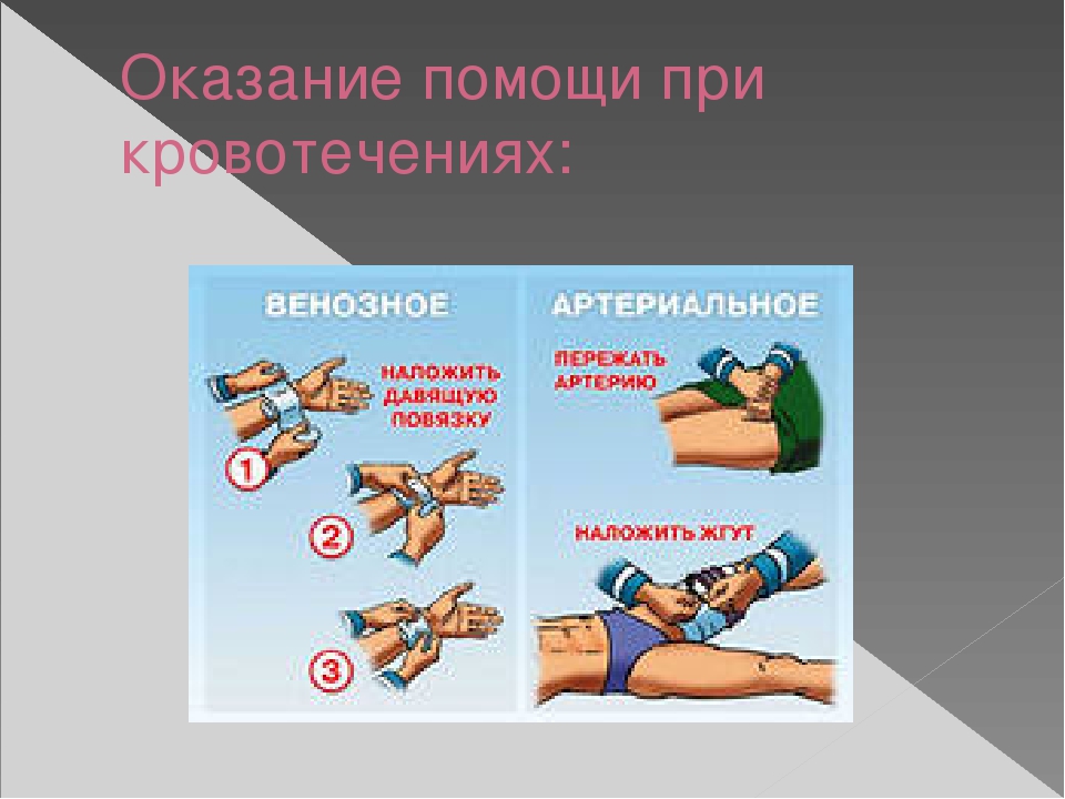 Презентация на тему первая медицинская помощь при кровотечении