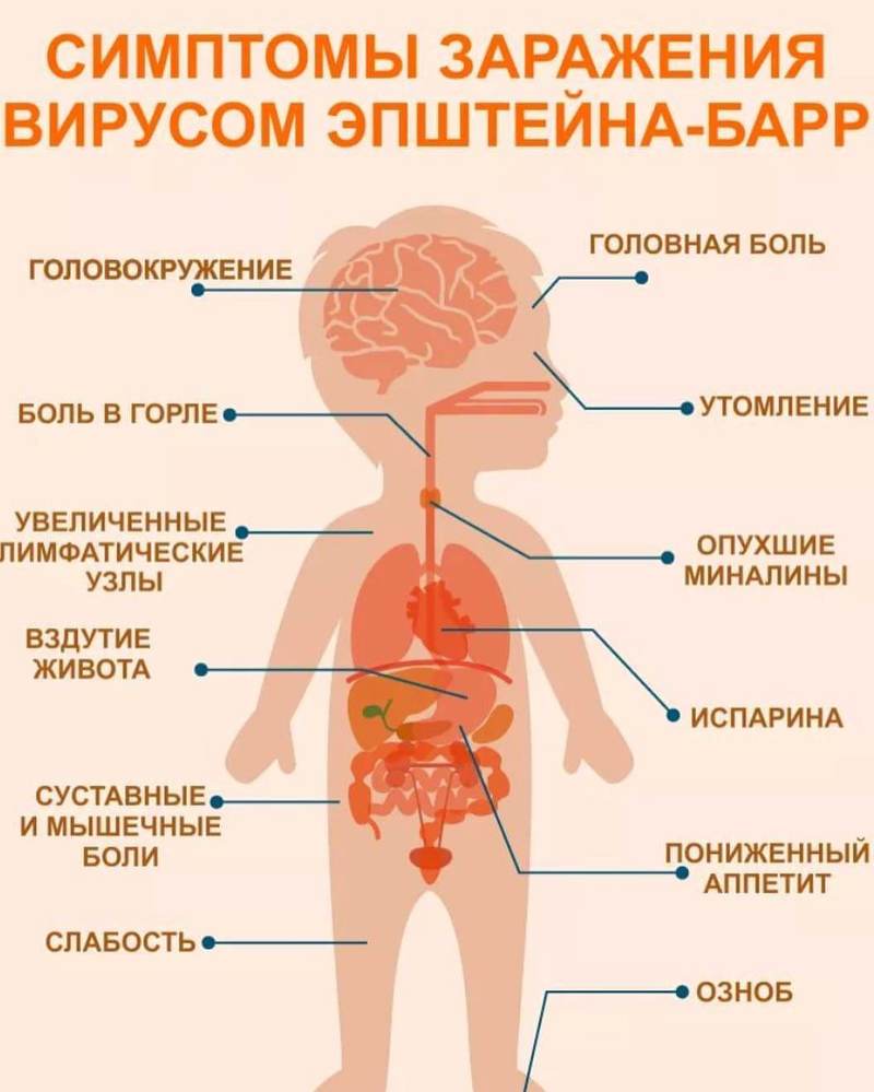 эпштейн бара