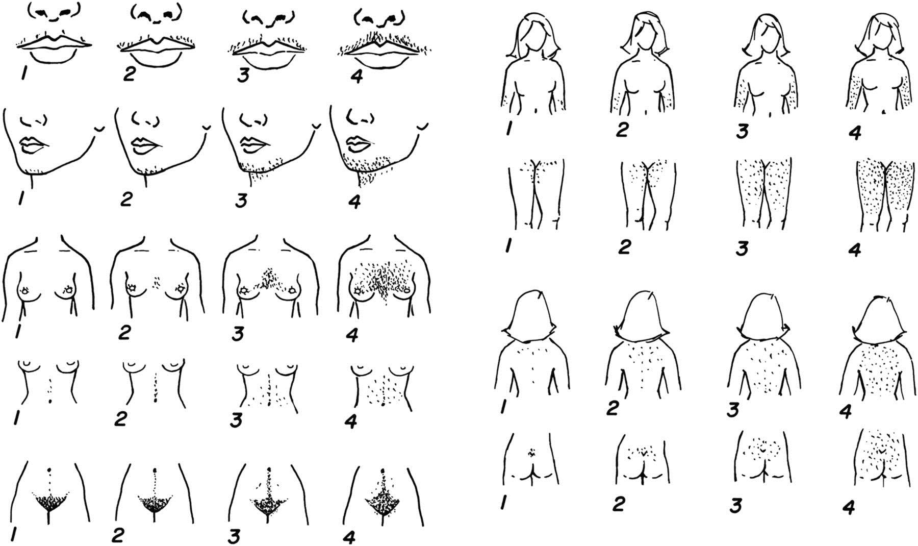 волосы на груди у женщин норма фото 3