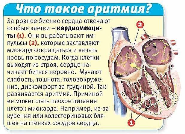 Можно ли выжить после остановки сердца