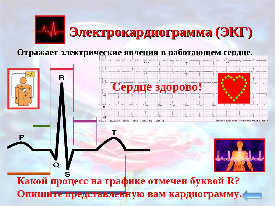 Презентация по экг