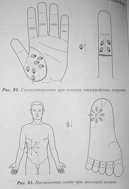 Массаж при кашле у ребенка для отхождения мокроты в картинках в