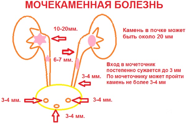 Боль в левом боку на уровне талии со спины, спереди, сбоку у женщин. Причины, лечение