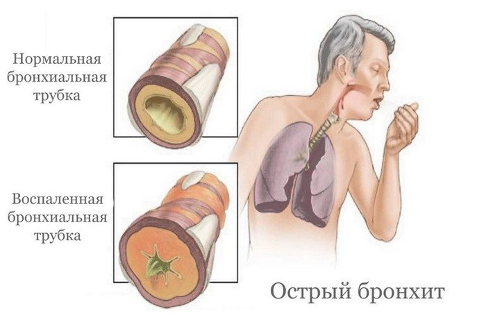 Боль под правой лопаткой сзади со спины. Причины и лечение