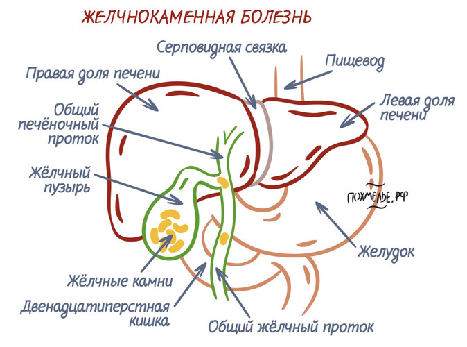 Боль под правой лопаткой сзади со спины. Причины и лечение