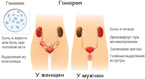 Болезненное мочеиспускание у женщин частое, в конце, с кровью. Причины и лечение