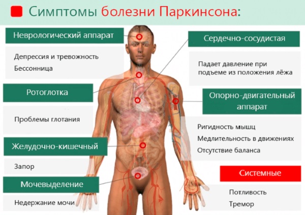 Старческое слабоумие. Симптомы и признаки у женщин, лечение деменции, препараты, уход