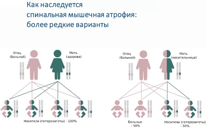 Спинально-мышечная атрофия у детей, взрослых. Что это такое, симптомы, лечение, клинические рекомендации