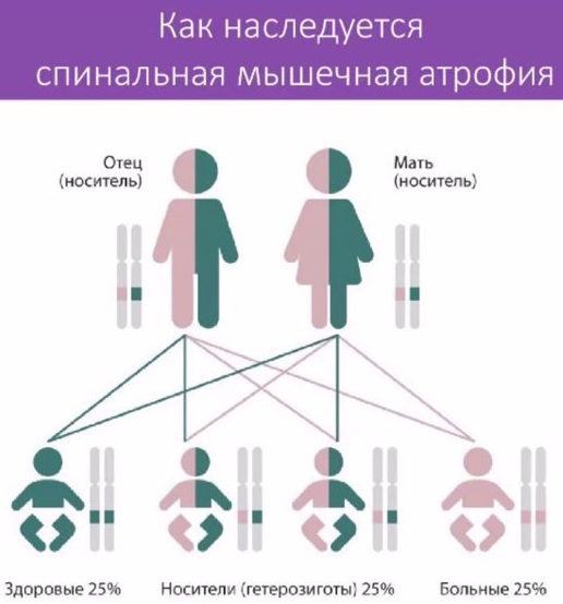 Спинально-мышечная атрофия у детей, взрослых. Что это такое, симптомы, лечение, клинические рекомендации