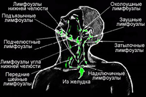 Лимфоузлы на шее расположение у ребенка схема фото с пояснениями