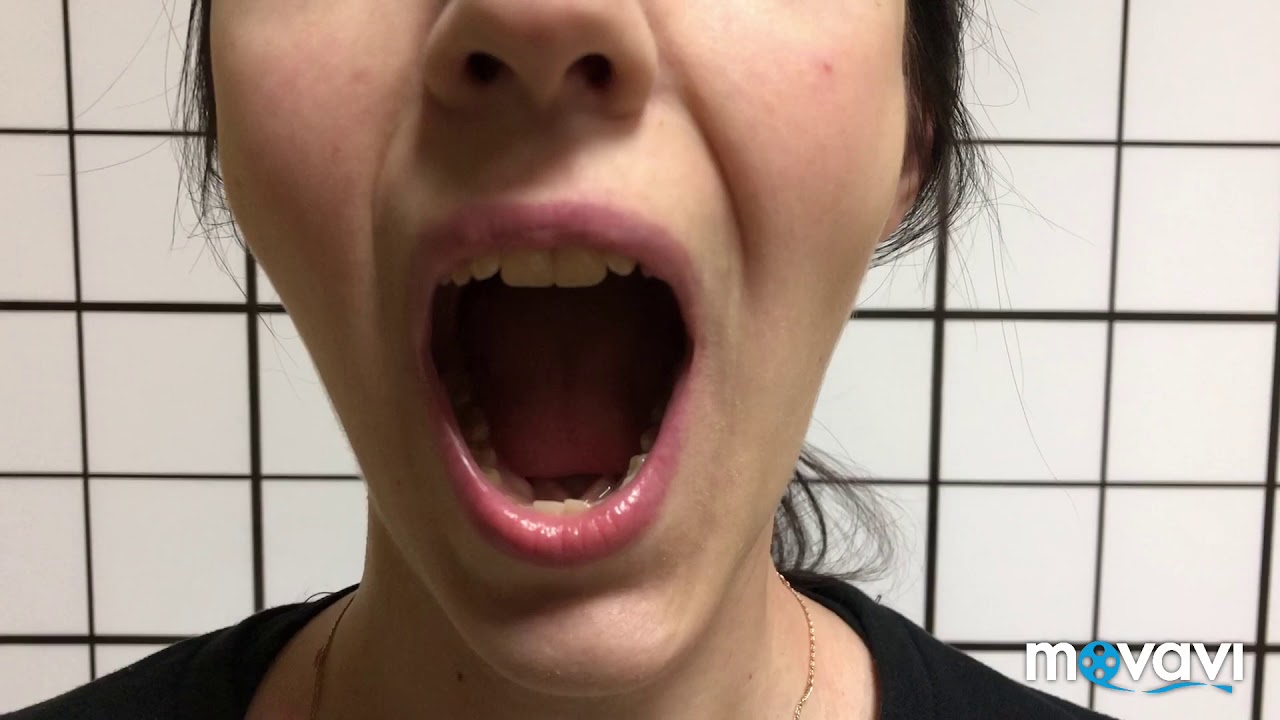 Резко открыла рот. Широкое открывание рта. Дисфункция височно-нижнечелюстного сустава упражнения. Движение челюсти при жевании.