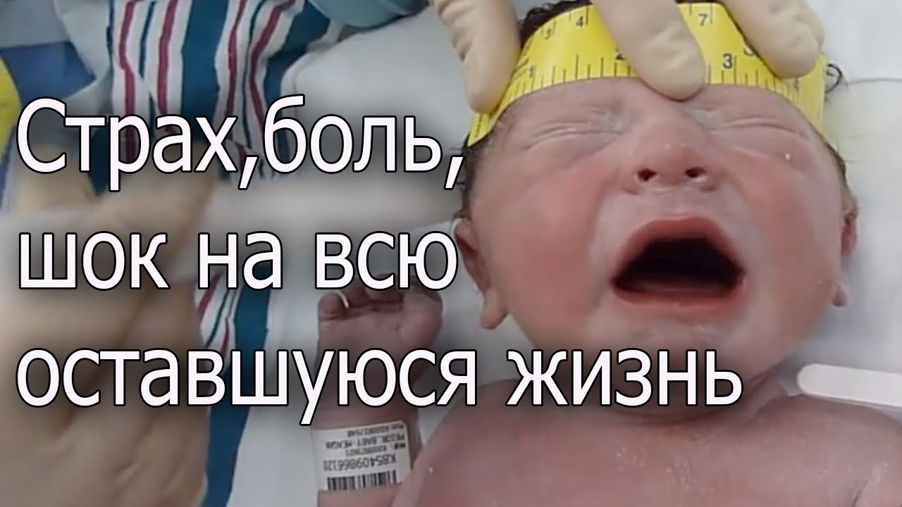 Болевой шок картинки