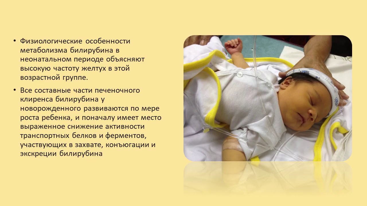 Физиологическая желтуха у новорожденных сколько. Физиологическая желтуха новорожденных. Желтушка у новорожденного. Ядерная желтуха новорожденных. Что такое ядерная желтуха у новорожденного.