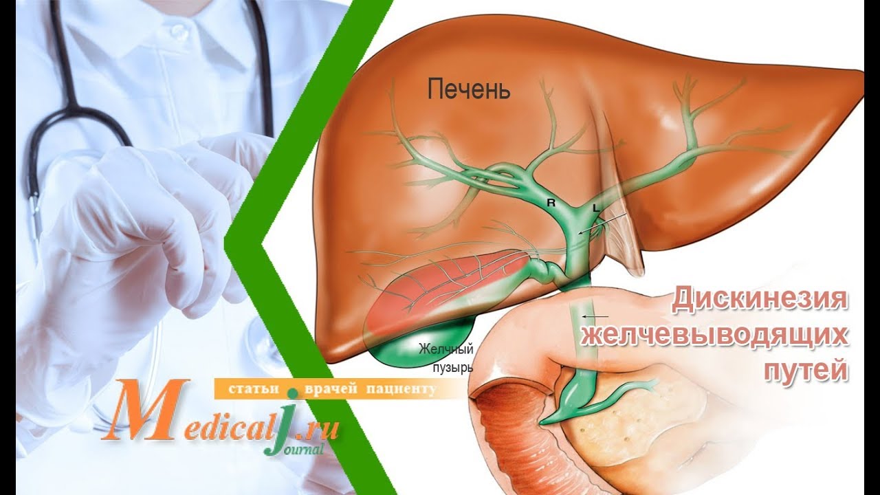 Эхо картина джвп