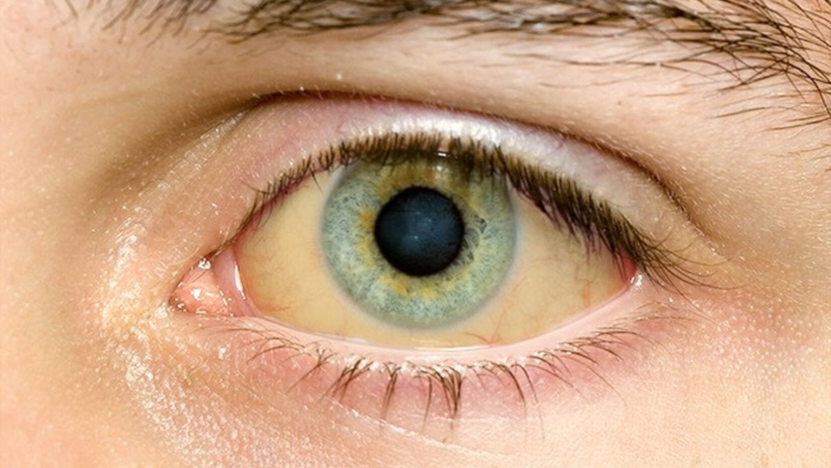 Описание желтых глаз