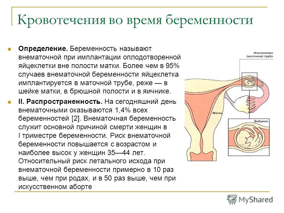 Имплантационное кровотечение на какой день. Кровотечение при беременности. Кровотечение при внематочной. Внематочная беременность кровотечение. Кровопотеря при внематочной беременности.