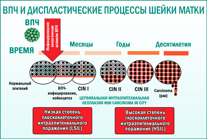 Впч это. Вирус папилломы человека типы. Типы папилломавируса человека. ВПЧ опасные типы.