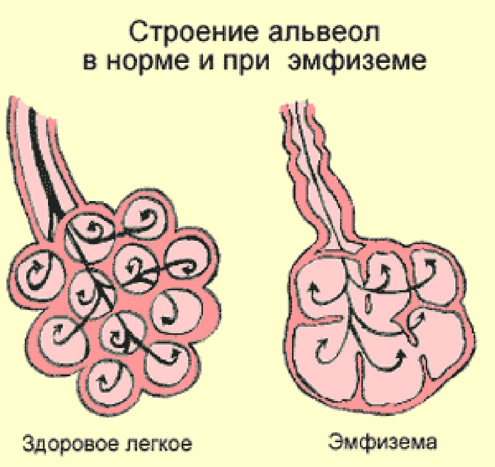 Поднялись легкие