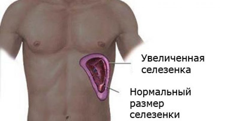 Припухлость ребра слева. Селезенка расположение в организме. Где находится селезенка у человека. Селезенка место расположения.